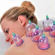 cuppingtherapy-180x180